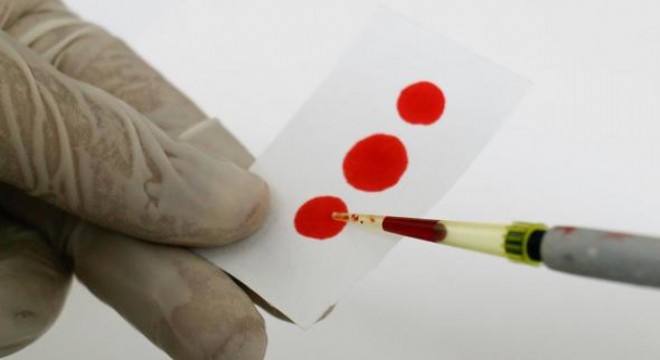 Hepatit Başkent'te masaya yatırılacak