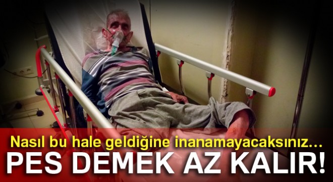 KOAH hastası kendini yaktı