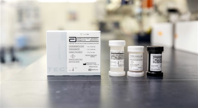 Koronavirüsle mücadelede yeni antikor testi artık Türkiye'de
