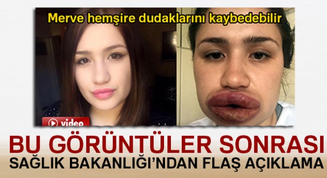 Sağlık Bakanlığından 'sahte estetik' açıklaması